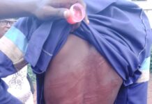 Corps member flogged by vigilantes on the order of landlord for late rent payment in Edo state is unjust to country serving youths